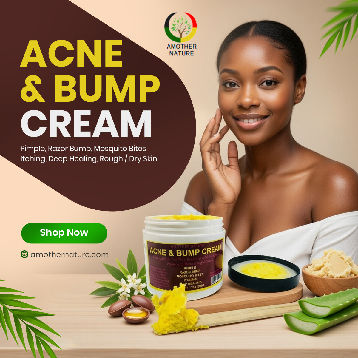 Acne & Bump Cream -(6 Pieces) @ $5.75/each