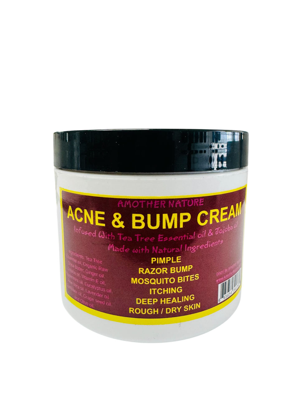 Acne & Bump Cream -(6 Pieces) @ $5.75/each