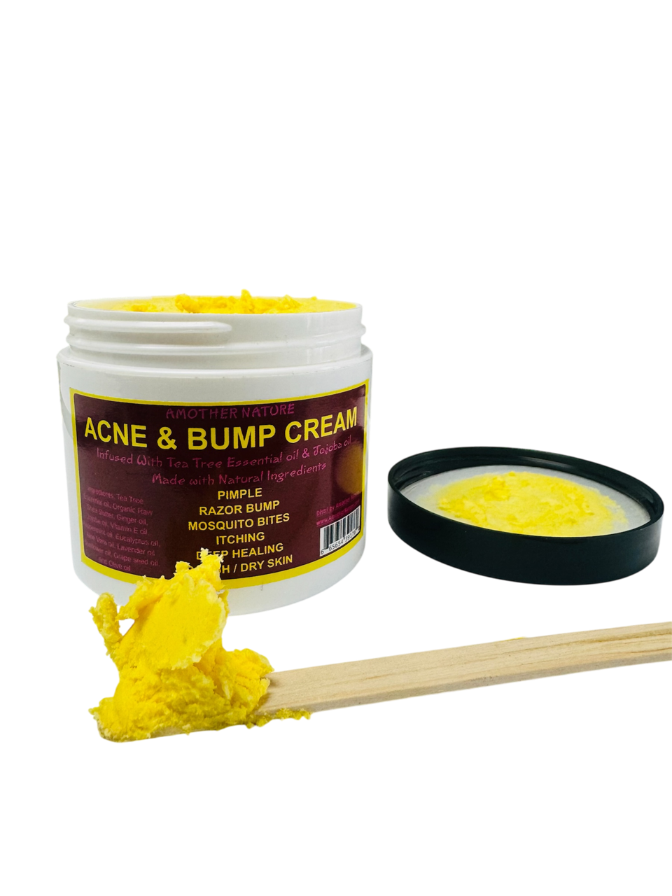 Acne & Bump Cream -(6 Pieces) @ $5.75/each